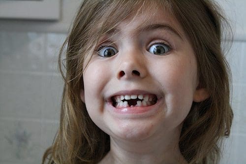 little girl with missing teeth